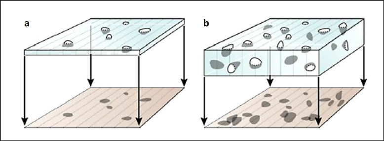 An Introduction to Stereology with Applications to the Glomerulus.