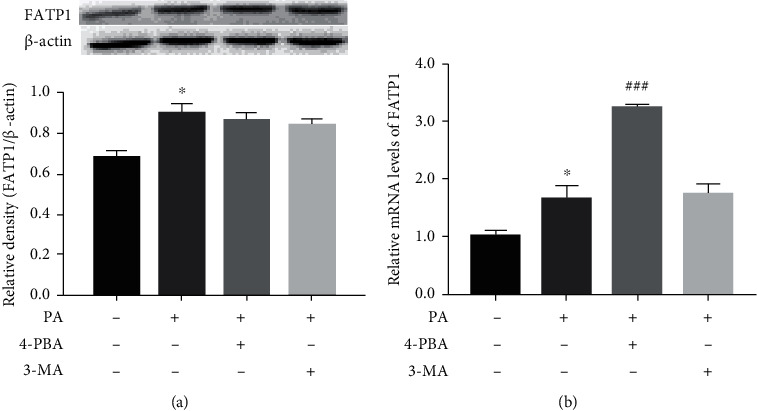 Interactions between Endoplasmic Reticulum Stress and Autophagy: Implications for Apoptosis and Neuroplasticity-Related Proteins in Palmitic Acid-Treated Prefrontal Cells.