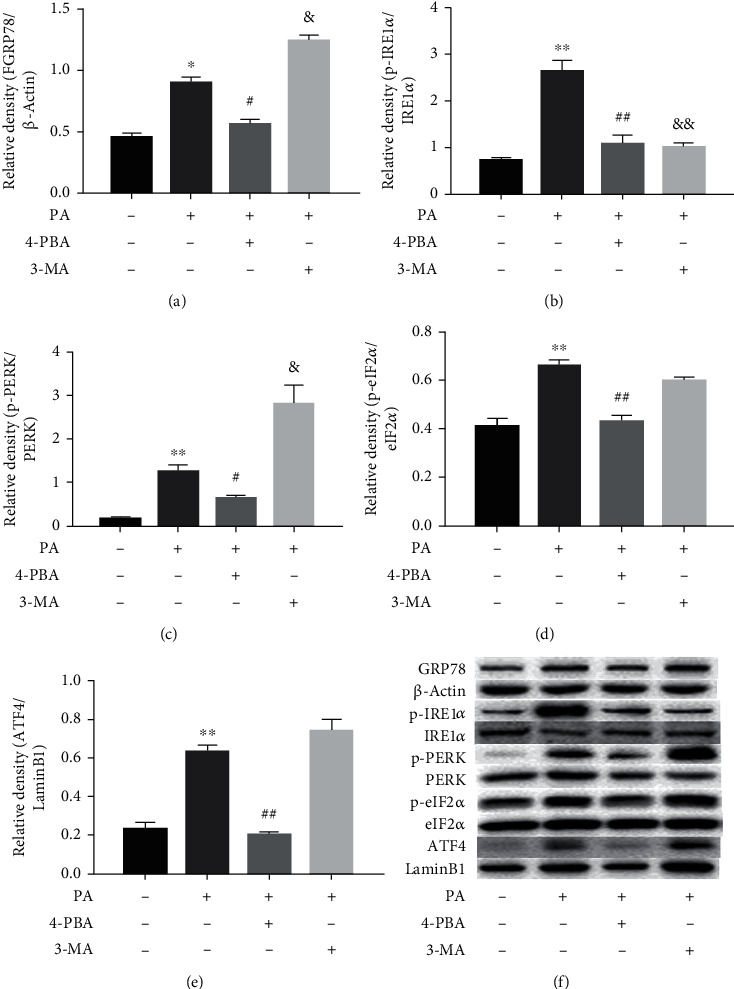 Interactions between Endoplasmic Reticulum Stress and Autophagy: Implications for Apoptosis and Neuroplasticity-Related Proteins in Palmitic Acid-Treated Prefrontal Cells.