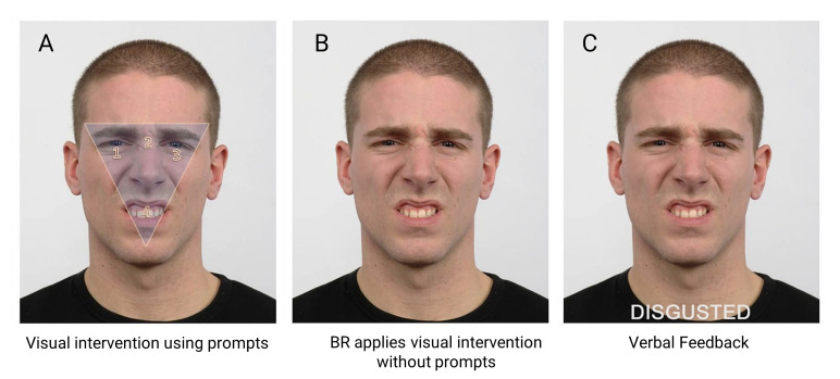 Visual scanpath training to emotional faces following severe traumatic brain injury: A single case design.