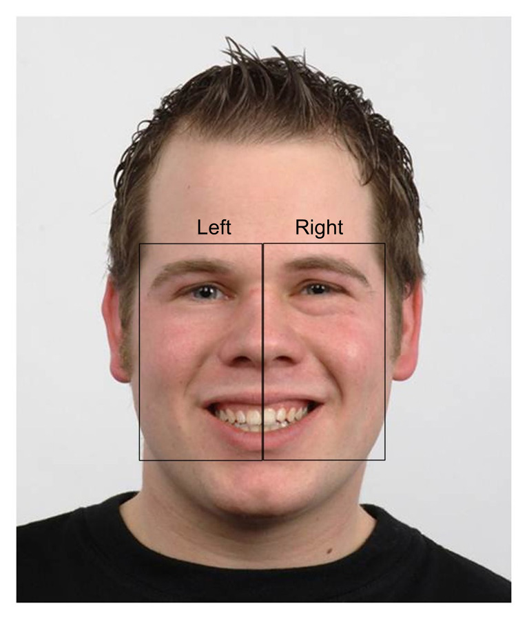 Visual scanpath training to emotional faces following severe traumatic brain injury: A single case design.