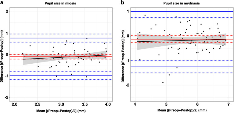 Dynamic assessment of variations in pupil diameter using swept-source anterior segment optical coherence tomography after phakic collamer lens implantation.
