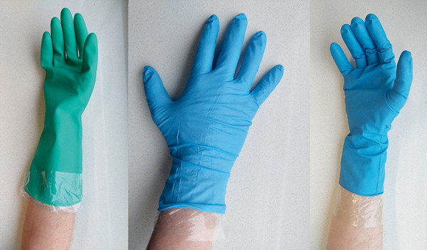 Allergic contact dermatitis to rubber accelerators in protective gloves: Problems, challenges, and solutions for occupational skin protection.