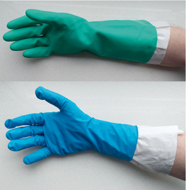 Allergic contact dermatitis to rubber accelerators in protective gloves: Problems, challenges, and solutions for occupational skin protection.