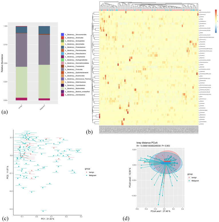 Comparison of the Gut Microbiota in Patients with Benign and Malignant Breast Tumors: A Pilot Study.