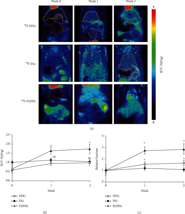 Comparison of <sup>18</sup>F-FDG, <sup>18</sup>F-Fluoroacetate, and <sup>18</sup>F-FEPPA for Imaging Liver Fibrosis in a Bile Duct-Ligated Rat Model.