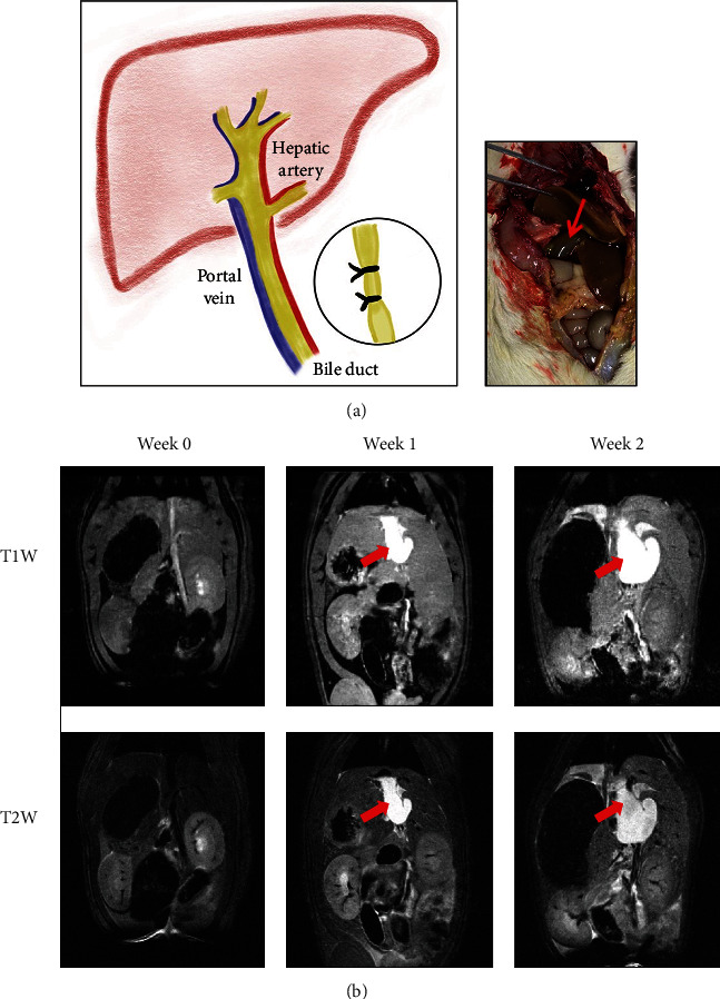 Comparison of <sup>18</sup>F-FDG, <sup>18</sup>F-Fluoroacetate, and <sup>18</sup>F-FEPPA for Imaging Liver Fibrosis in a Bile Duct-Ligated Rat Model.