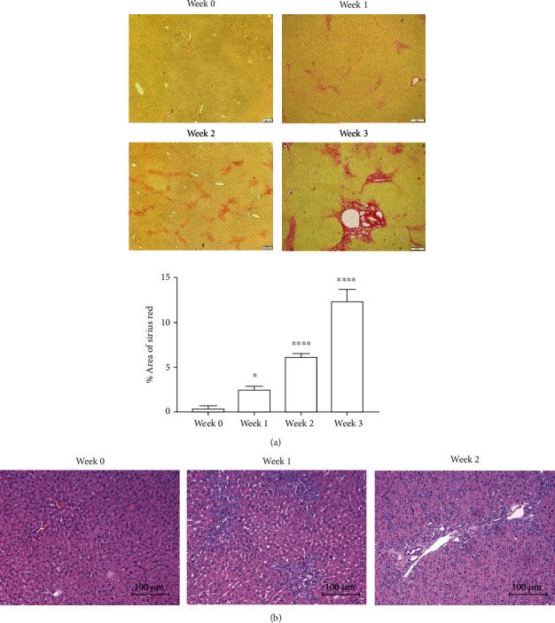 Comparison of <sup>18</sup>F-FDG, <sup>18</sup>F-Fluoroacetate, and <sup>18</sup>F-FEPPA for Imaging Liver Fibrosis in a Bile Duct-Ligated Rat Model.