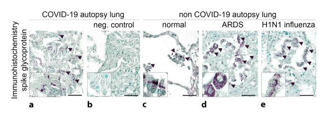 Detection methods for SARS-CoV-2 in tissue.