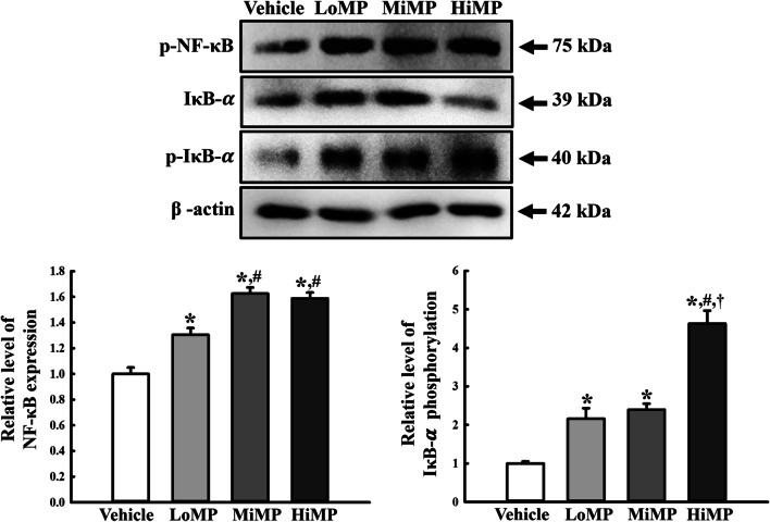 Inflammatory response in the mid colon of ICR mice treated with polystyrene microplastics for two weeks.