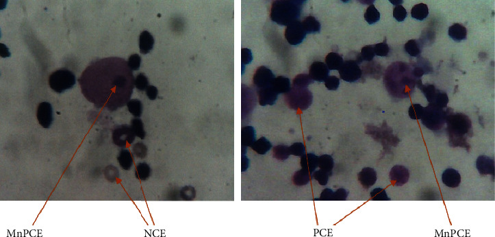 Genotoxicity Assessment and Protective Effect of <i>Anogeissus leiocarpus</i> Roots against Cyclophosphamide-Induced DNA Damage In Vivo.