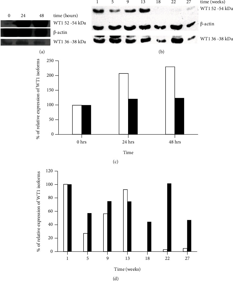 Truncated WT1 Protein Isoform Expression Is Increased in MCF-7 Cells with Long-Term Estrogen Depletion.