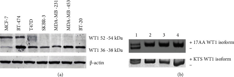 Truncated WT1 Protein Isoform Expression Is Increased in MCF-7 Cells with Long-Term Estrogen Depletion.