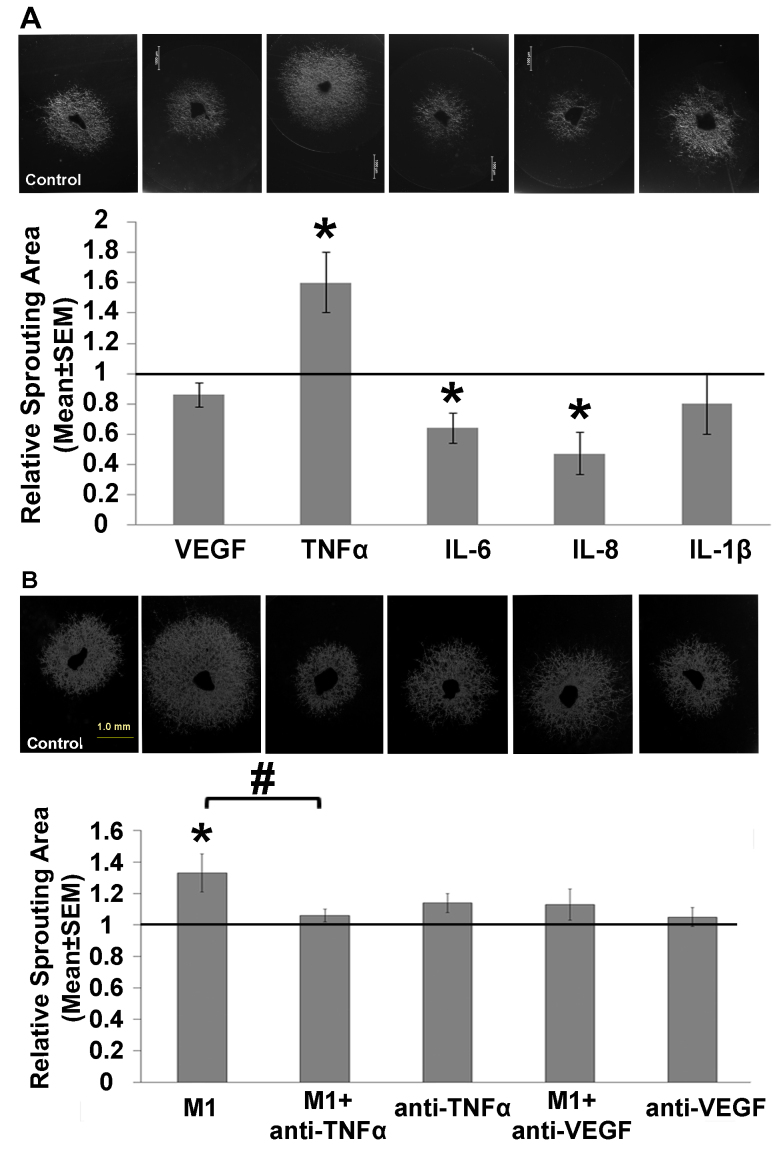 Anti-tumor necrosis factor alpha reduces the proangiogenic effects of activated macrophages derived from patients with age-related macular degeneration.