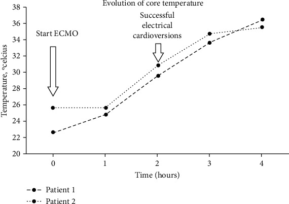 Use of Extracorporeal Membrane Oxygenation in Patients with Refractory Cardiac Arrest due to Severe Persistent Hypothermia: About 2 Case Reports and a Review of the Literature.