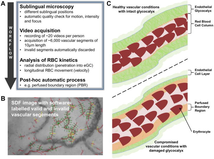 Protection and rebuilding of the endothelial glycocalyx in sepsis – Science or fiction?