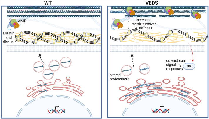 Four decades in the making: Collagen III and mechanisms of vascular Ehlers Danlos Syndrome