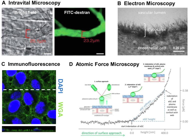 Protection and rebuilding of the endothelial glycocalyx in sepsis – Science or fiction?