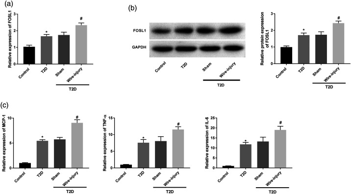 Silencing of FOS-like antigen 1 represses restenosis <i>via</i> the ERK/AP-1 pathway in type 2 diabetic mice.