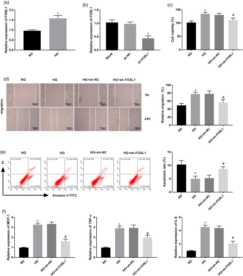 Silencing of FOS-like antigen 1 represses restenosis <i>via</i> the ERK/AP-1 pathway in type 2 diabetic mice.