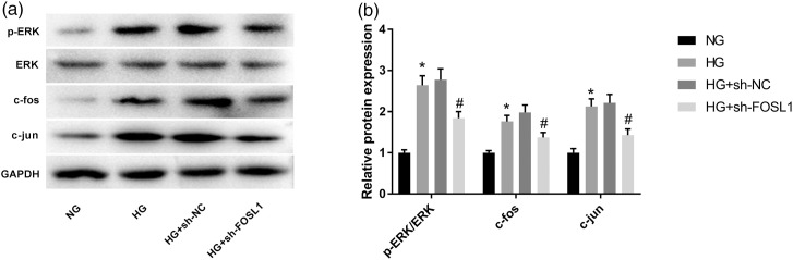 Silencing of FOS-like antigen 1 represses restenosis <i>via</i> the ERK/AP-1 pathway in type 2 diabetic mice.