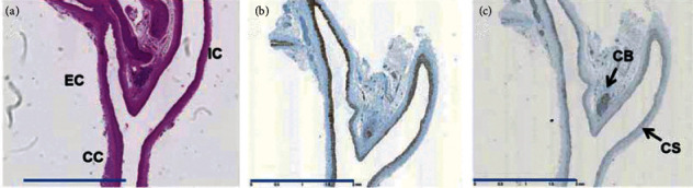 Sympathetic Nerve Activity and Baroreflex are Strongly Altered in a Context of Severe Hypertension Using the Spontaneously Hypertensive Rat Model Associated with Chronic Reduction of Nitric Oxide.