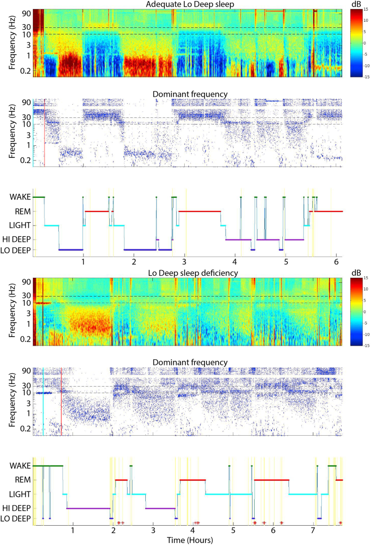 Amount of < 1Hz deep sleep correlates with melatonin dose in military veterans with PTSD