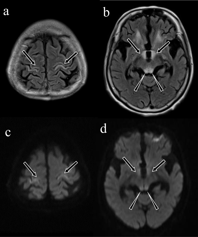 Imaging findings of vitamin deficiencies: are they forgotten diseases?