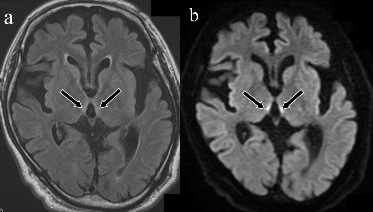 Imaging findings of vitamin deficiencies: are they forgotten diseases?