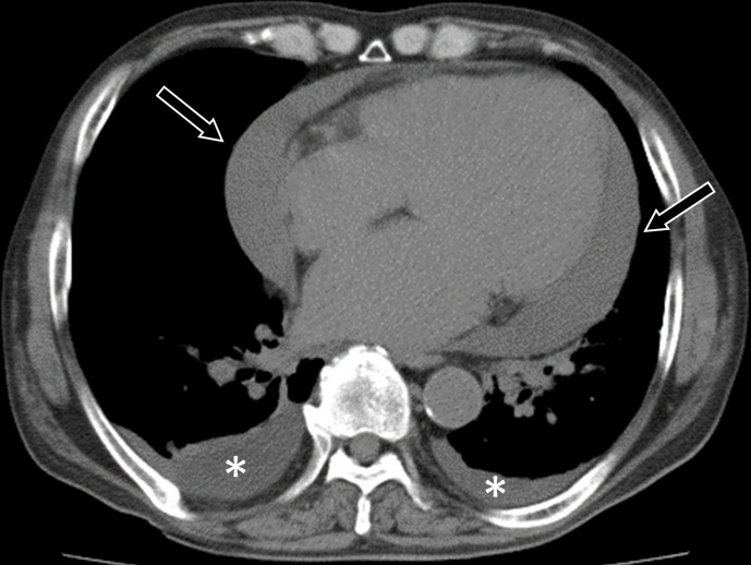 Imaging findings of vitamin deficiencies: are they forgotten diseases?