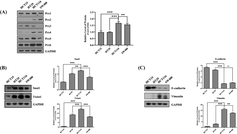 Peroxiredoxin-6 regulates p38-mediated epithelial-mesenchymal transition in HCT116 colon cancer cells.