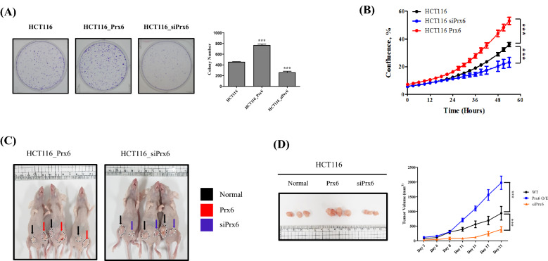 Peroxiredoxin-6 regulates p38-mediated epithelial-mesenchymal transition in HCT116 colon cancer cells.