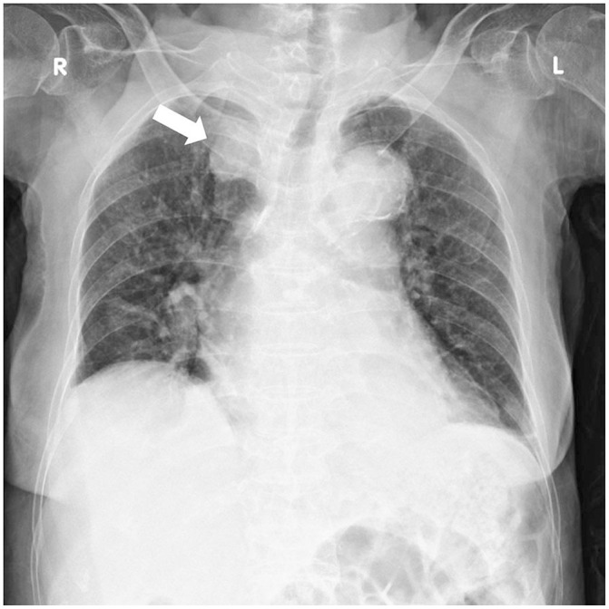 [Peer Review of Teleradiology at a Teleradiology Clinic: Comparison of Unacceptable Diagnosis and Clinically Significant Discrepancy between Radiology Sections and Imaging Modalities].