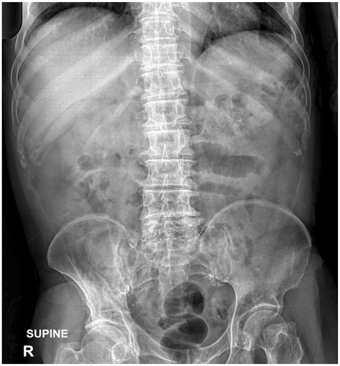 [Peer Review of Teleradiology at a Teleradiology Clinic: Comparison of Unacceptable Diagnosis and Clinically Significant Discrepancy between Radiology Sections and Imaging Modalities].
