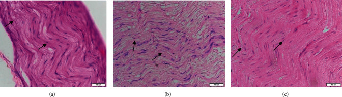 Protective Effect of Hyperbaric Oxygen Treatment on Axon Degeneration after Acute Motor Axonal Neuropathy.