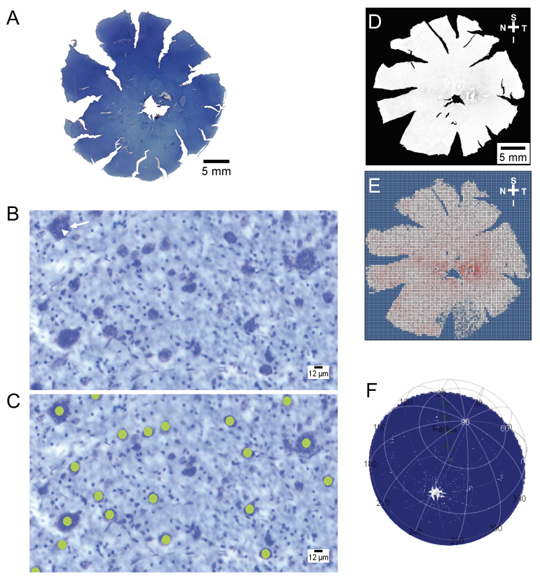 Mapping retinal ganglion cell somas in a large-eyed glaucoma model.