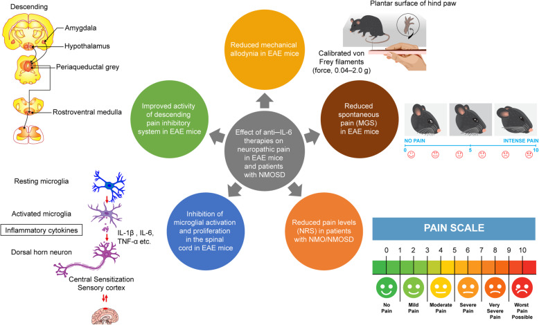 Interleukin-6: evolving role in the management of neuropathic pain in neuroimmunological disorders.