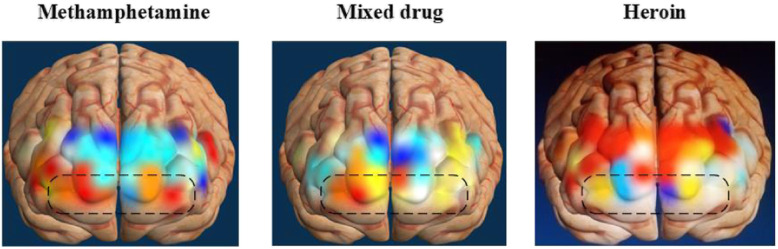 Prefrontal fNIRS-based clinical data analysis of brain functions in individuals abusing different types of drugs.