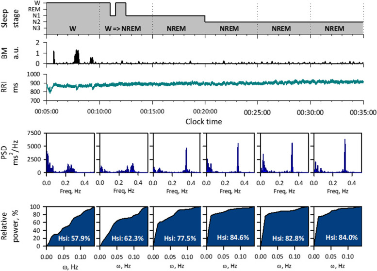 Assessment of autonomic function by long-term heart rate variability: beyond the classical framework of LF and HF measurements.