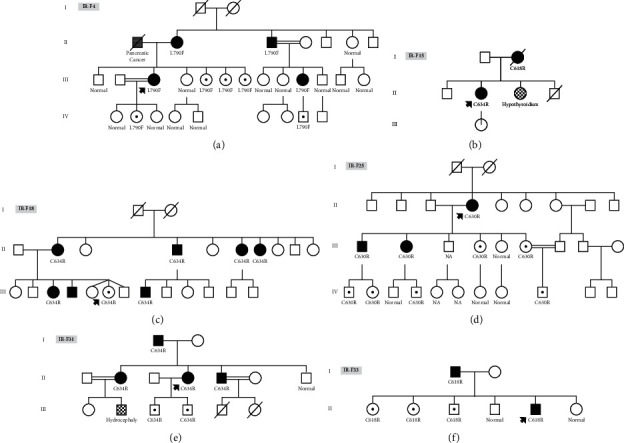 <i>RET</i> Proto-Oncogene Mutational Analysis in 45 Iranian Patients Affected with Medullary Thyroid Carcinoma: Report of a New Variant.