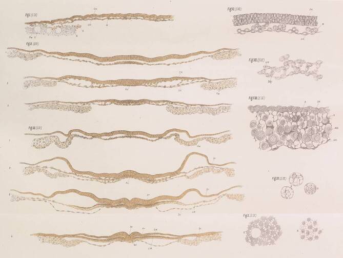 Wilhelm His Sr. and the development of paraffin embedding.