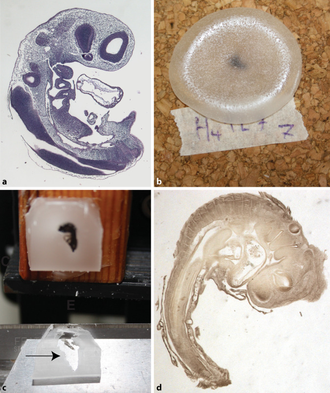 Wilhelm His Sr. and the development of paraffin embedding.