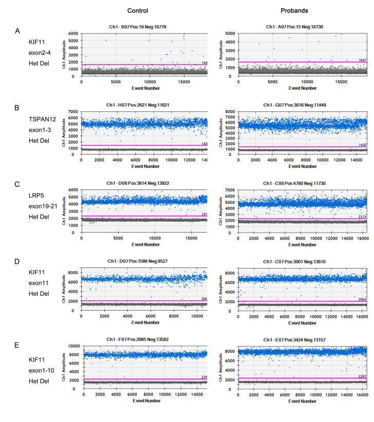 Five novel copy number variations detected in patients with familial exudative vitreoretinopathy.