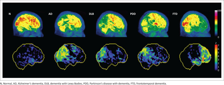 PET-CT in brain disorders: The South African context.