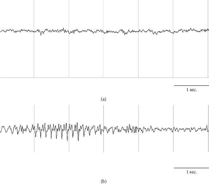 Clothianidin and Thiacloprid Mixture Administration Induces Degenerative Damage in the Dentate Gyrus and Alteration in Short-Term Memory in Rats.