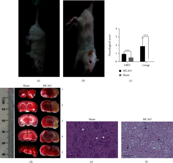 Deep Sequencing of the Rat MCAO Cortexes Reveals Crucial circRNAs Involved in Early Stroke Events and Their Regulatory Networks.