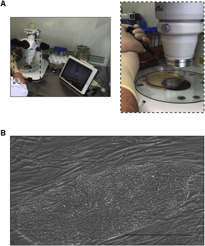Tips and tricks for successfully culturing and adapting human induced pluripotent stem cells.