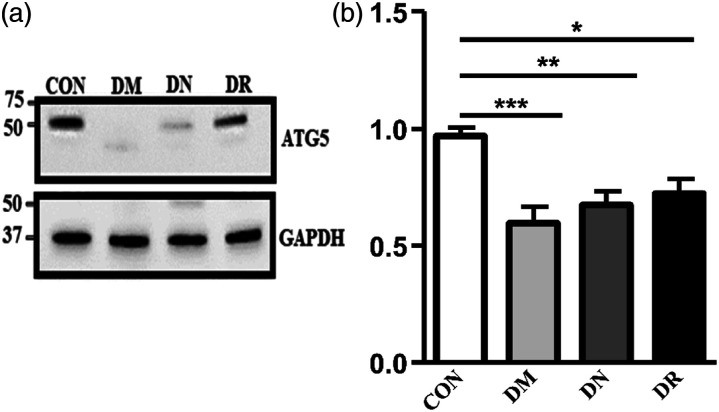 Alteration of autophagy-related protein 5 (ATG5) levels and Atg5 gene expression in diabetes mellitus with and without complications.