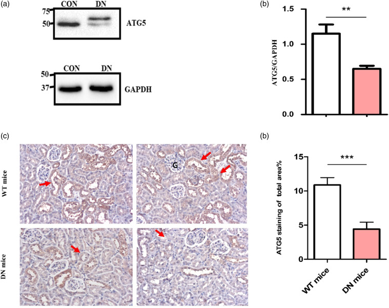 Alteration of autophagy-related protein 5 (ATG5) levels and Atg5 gene expression in diabetes mellitus with and without complications.