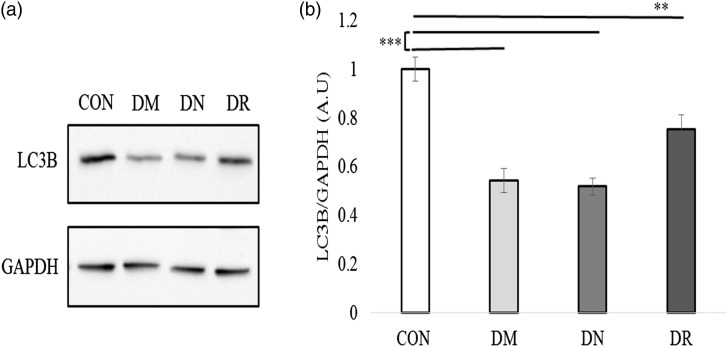 Alteration of autophagy-related protein 5 (ATG5) levels and Atg5 gene expression in diabetes mellitus with and without complications.